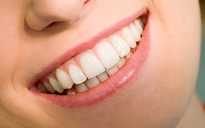 Interventi Parodontali - Trattamenti efficaci per curare la malattia parodontale presso la Clinica Dentale Ghiatto.