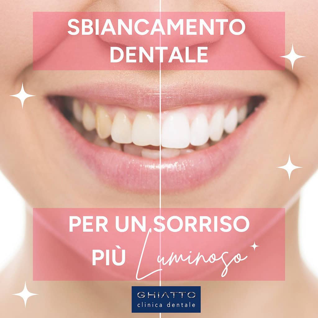 denti bianchi